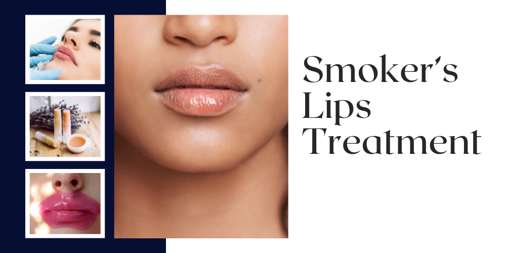 Read more about the article Smokers Lips Treatment