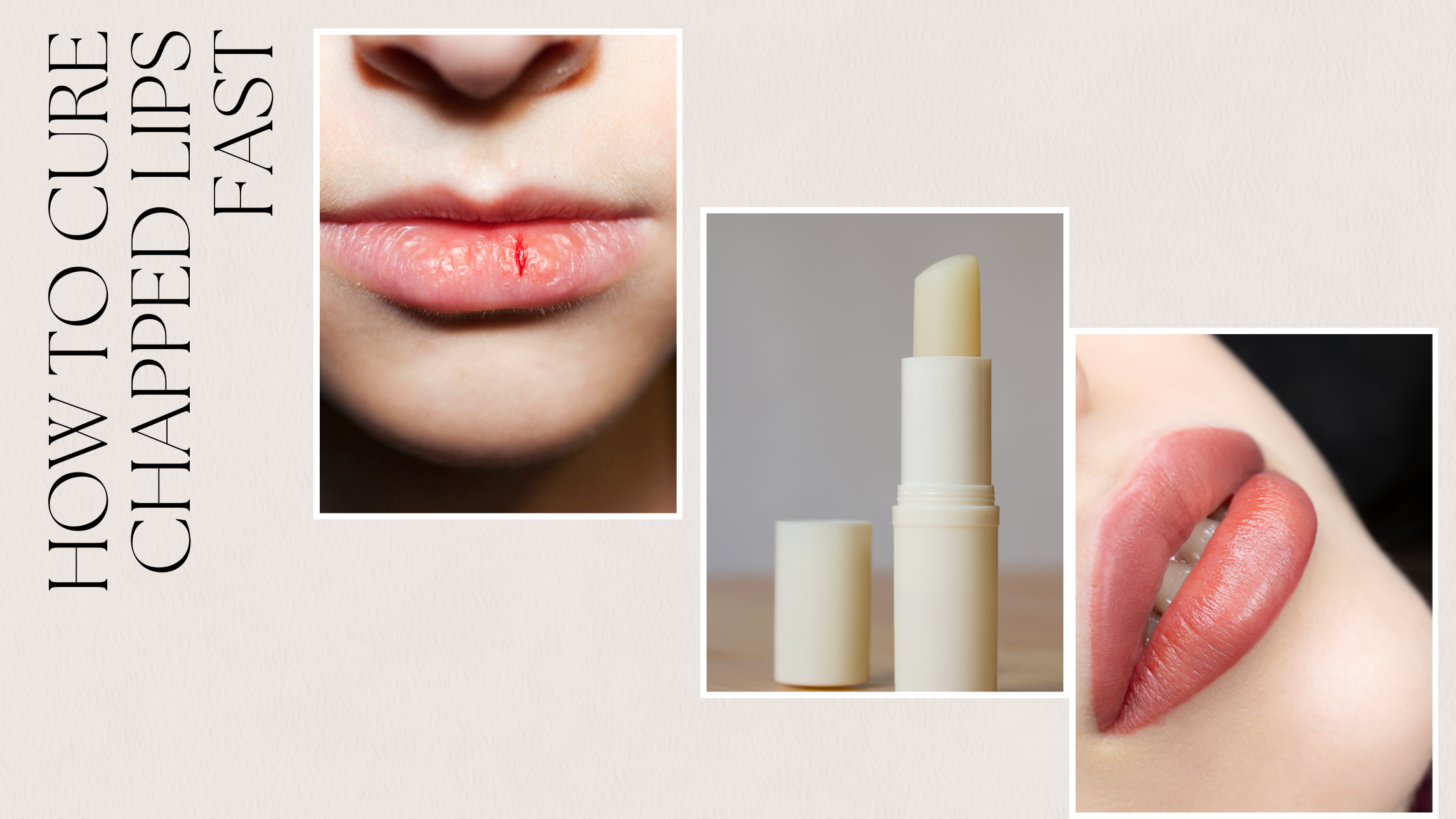 Read more about the article How to cure chapped lips fast